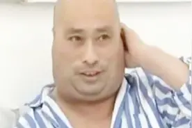 常年大量酗酒，男子患上粗脖子病，脂肪堆在脖子周围显得异常粗大视频封面