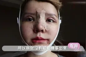 小姐姐去韩国整容全过程，效果还不错视频封面