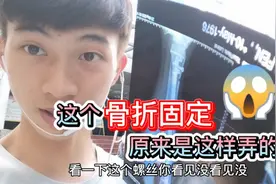 第一次看见骨折固定！钢钉和钢板原来是这样用的，太吓人了！视频封面
