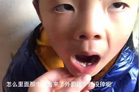 宝的牙齿活动了好多天，外面的没掉里面长出一个小牙，有啥好建议视频封面