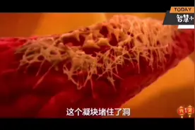 好神奇：3D动画模拟伤口愈合的全过程！视频封面