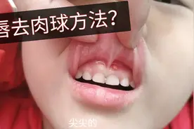 嘴唇上方长个肉球，疫情期间，该如何处理呢？视频封面