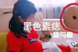 宝宝小腿长黑痣，面积变大颜色深，9岁必须做手术，啥痣这么严重视频封面