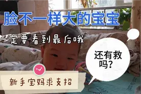 我们家的宝宝，现在脸一边大一边小 求支招视频封面