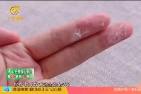 502胶水粘手怎么办？教你一个小妙招轻松去除，太实用了！视频封面