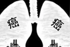 肺癌有望变成慢性病？没错！科技发展诊疗不断出新，疾病不再可怕视频封面