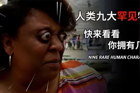 莲花舌、动耳朵、 人类九种罕见特征，快来看看你有几个？视频封面