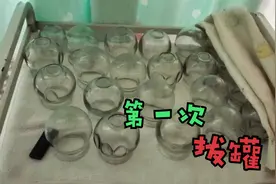 80后卡嫂第一次体验拔罐，结果疼得直掉眼泪，真是花钱买罪受视频封面