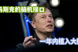 中风偏瘫的病友看到希望了，马斯克的研究一年内可成功，太期待了视频封面