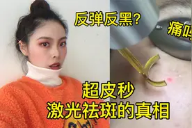超皮秒激光祛斑会反弹反黑、让皮肤变薄吗？内行人告诉你真相…视频封面