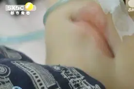核桃卡气管两岁娃咳嗽不止 家长误以为是感冒视频封面