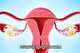 妇科病老是“纠缠”你，要提防可能与你老公“不干净”有关系视频封面