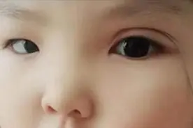 宝妈想让女儿有高颜值，动手给女儿DIY双眼皮，网友：看着就难受视频封面