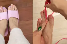 女子从小到大不敢穿凉鞋，怕脚趾畸形吓到别人，网友：给生活比耶视频封面