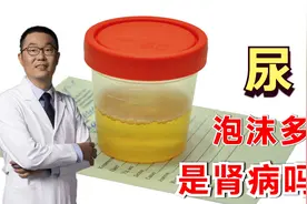 尿里泡沫多，是不是有肾病？医生总结：分为2种情况，不都是病！视频封面