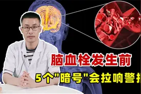 脑血栓来临前，5个信号会拉响“警报”！察觉到异常务必趁早干预视频封面