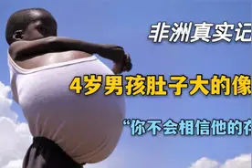 非洲真实纪录，4岁男孩肚子和孕妇一样大，男孩到底经历了什么视频封面