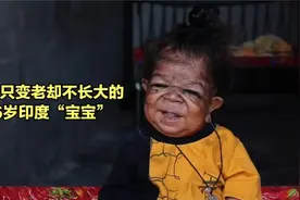 一个不长大只变老的孩子，26岁了依然还像个未满周岁的宝宝！视频封面