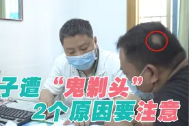 斑秃俗称“鬼剃头”，是哪些原因造成的，头发还能再长回来吗视频封面