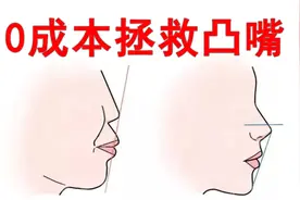 1招改善凸嘴，养成完美侧颜视频封面