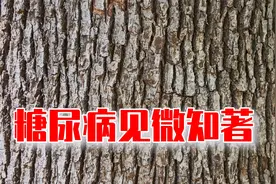 傅茂恒大夫：糖尿病人皮肤干枯色斑透露病情控制不良视频封面