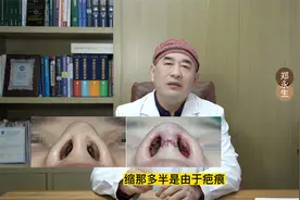 整形医生告诉你：隆鼻后鼻头挛缩该怎么办？1分钟给你讲明白！视频封面