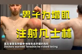 俄罗斯男子为增肌双臂注射6公斤凡士林 现面临生命危险视频封面