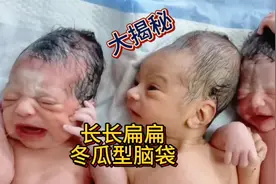 大揭秘 为什么很多刚出生娃娃的头型都是长长扁扁的像冬瓜视频封面