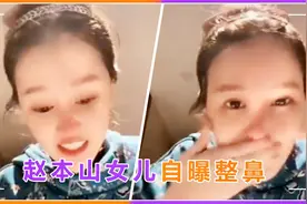 赵本山女儿直播自曝整容，揉搓鼻子通红险变形，直言：它是假的！视频封面