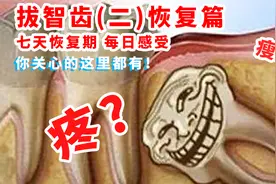 媳妇拔智齿七天恢复期每日感受，害怕拔智齿必看！关心的这里都有视频封面