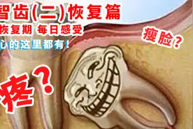 媳妇拔智齿七天恢复期每日感受，害怕拔智齿必看！关心的这里都有视频封面