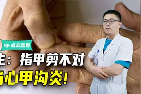 再次提醒：别再把指甲剪成圆弧形！指甲剪不对，当心甲沟炎视频封面