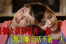 神奇的連體雙胞胎：五感共用，姐姐甚至能控制妹妹身體！视频封面