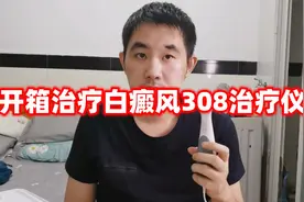 开箱治疗白癜风的308光疗仪 东西小巧又挺贵赠品倒是挺多的视频封面