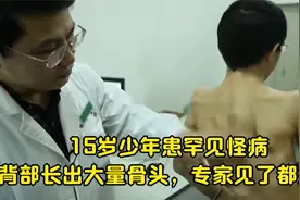 15岁少年患罕见怪病，背部长出大量骨头，专家见了都摇头，纪录片视频封面