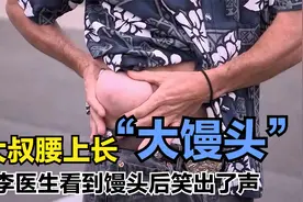 外国大叔腰上长肿块，医生两手一挤一整块，太爽了视频封面