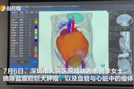 9斤重肿瘤从子宫“爬”进心脏，14个科室接力手术成功摘除视频封面