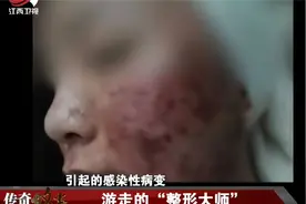 传奇：年轻女子特爱美，脑子一热预约上门整形，谁知全脸毁容视频封面