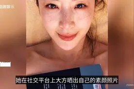 超模隋棠晒雀斑照！因有人盗用照片卖淡斑产品，曾与黄晓明演情侣视频封面
