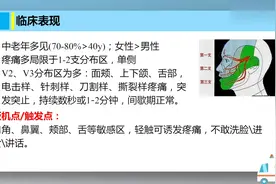 脑神经疾病之三叉神经痛 — 特发性面神经麻痹视频封面