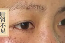 身体出现这4个症状，十有八九是肝肾不足，一定要及时补回来！视频封面