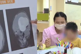 5-8岁为儿童脑肿瘤发病高峰期，这些症状要警惕！视频封面