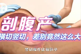 剖腹产横切竖切，差别竟然这么大！别乱选，两者大不同~视频封面