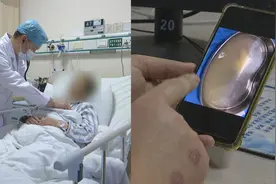 福州一女子排出白色浑浊尿液，竟与吃肉有关？医生：十分罕见视频封面