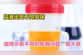 尿液出现不同异味，或是4类健康问题征兆，别不当回事视频封面