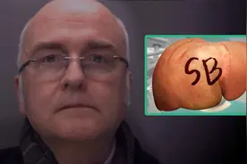 英国医生在病人肝脏上刻“SB”留念：是姓名缩写，自称压力太大视频封面