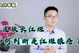 皮肤长红斑，如果有这几大特点，可能是红斑狼疮“找上门”了视频封面