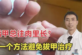 脚趾甲总往肉里长，甲沟炎找上门？医生教你一招甲矫正术！视频封面
