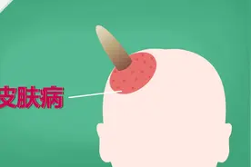 美女子头上长出“犀牛角”手术摘除 动画揭这是啥“怪”病？tt视频封面