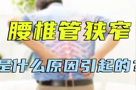 腰椎管狭窄症，到底是哪里出了问题？医生的通俗讲解，非常清晰视频封面